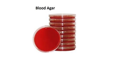 1.19: Blood Agar .